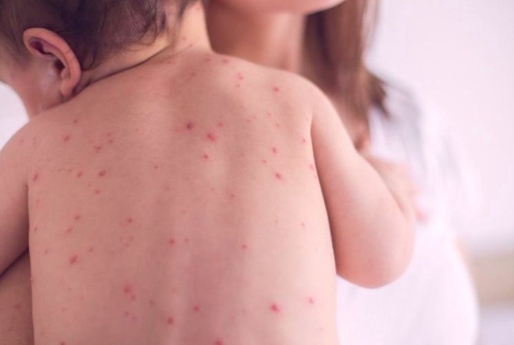 Эрүүл Мэндийн Яам (Улаанбурхан) Эрүүл Мэндийн Яам (Улаанбурхан)