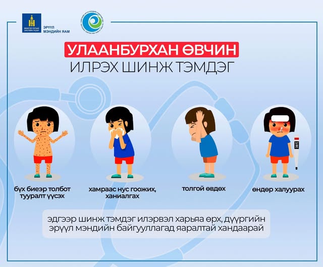 Улаанбурхан өвчний халдвараас сэргийлье