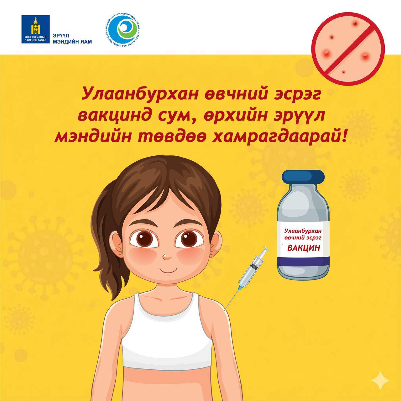 Улаанбурхан өвчнөөс сэргийлье