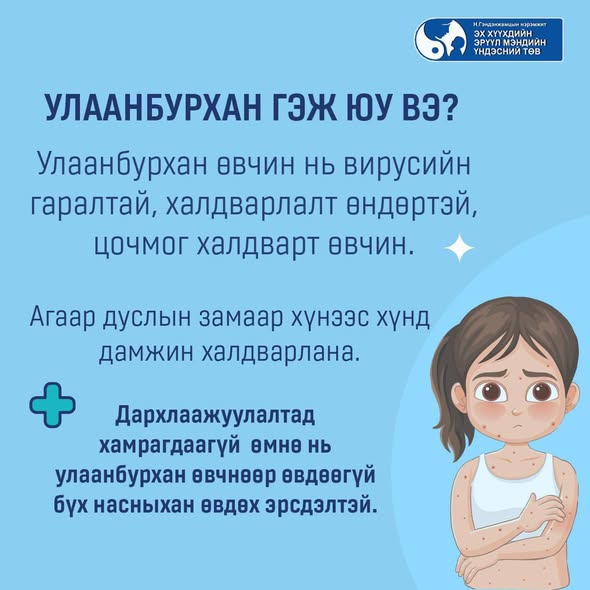 УЛААНБУРХАН ӨВЧНИЙ ТАЛААРХ СЭРЭМЖЛҮҮЛЭГ ЗӨВЛӨГӨӨ