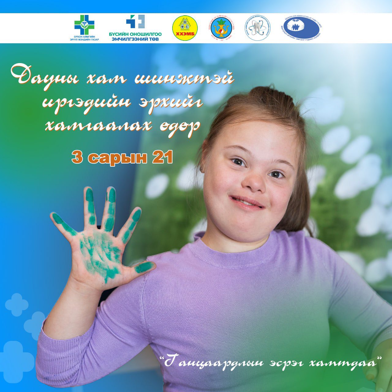 “3 сарын 21” Дэлхийн дауны хам шинжийн өдөр