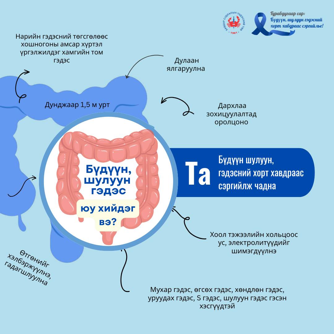 Бүдүүн, шулуун гэдэсний хавдраас сэргийлье